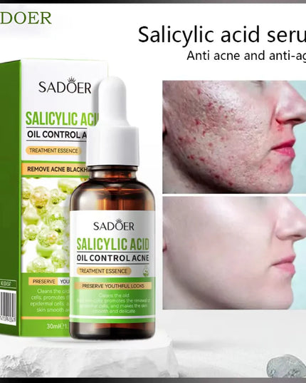 SADOER Salicylic Acid Oil Control Treatment Essence – 30ml