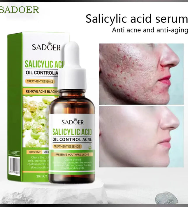 SADOER Salicylic Acid Oil Control Treatment Essence – 30ml