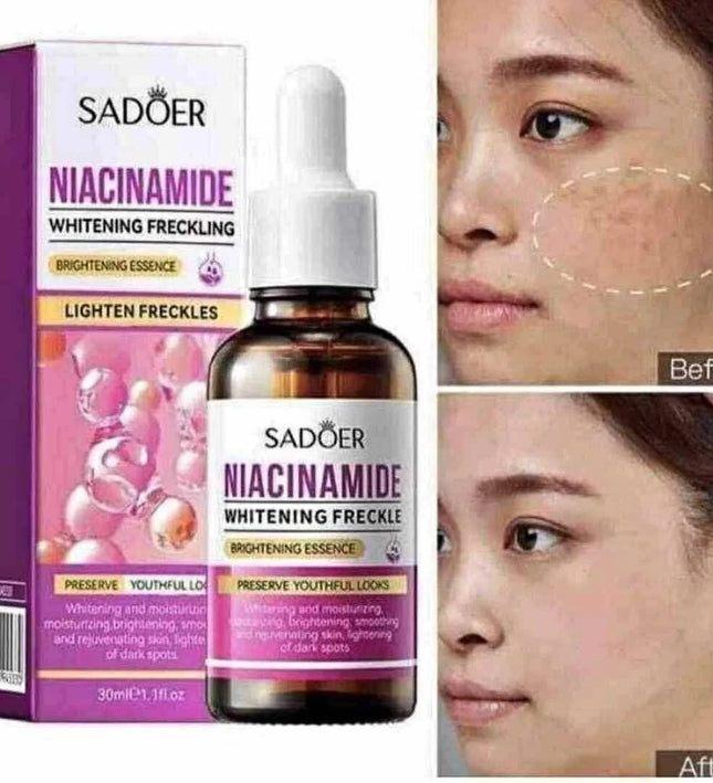 SADOER Niacinamide Brightening Essence – 30ml