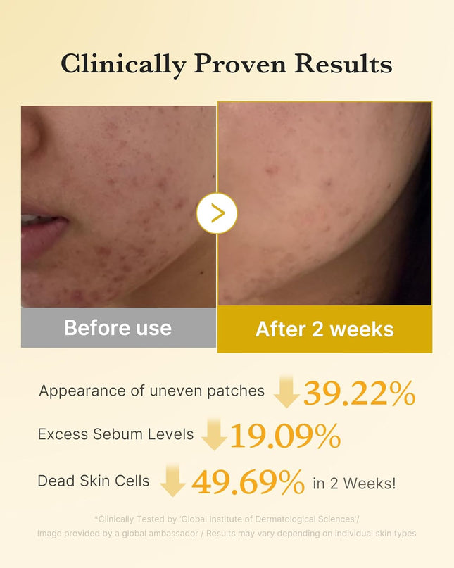 Medicube Arbutin & Turmeric Clarifying Toner Pads for Problem Skin