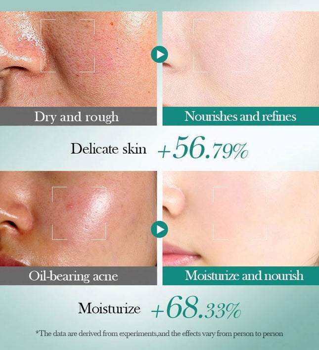 Hyaluronic Acid Moisturizing Repair Set Vitamin C Brightening Firming Facial Skin Care Face Cream