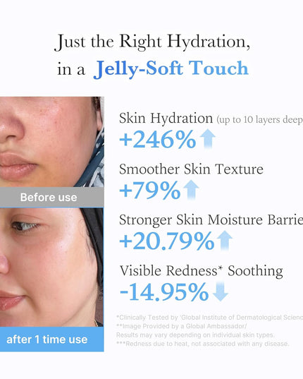 Medicube Acid Moisturizing Jelly Cream