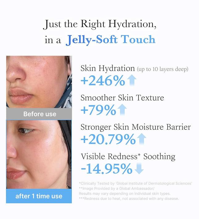 Medicube Acid Moisturizing Jelly Cream