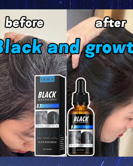 MOIKA Black Hair Serum for Hair Loss 30ml