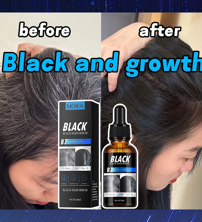MOIKA Black Hair Serum for Hair Loss 30ml