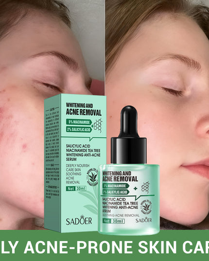 SADOER Salicylic Acid + Niacinamide Tea Tree Anti-Blemish Skincare 5-Piece Set