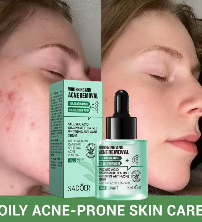SADOER Salicylic Acid + Niacinamide Tea Tree Anti-Blemish Skincare 5-Piece Set