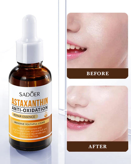 SADOER Astaxanthin Anti-Oxidation Repair Essence – 30ml