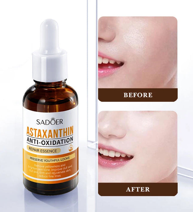 SADOER Astaxanthin Anti-Oxidation Repair Essence – 30ml